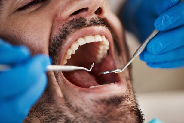 Best Emergency Dental Care for Sports Injuries in Hamburg, PA